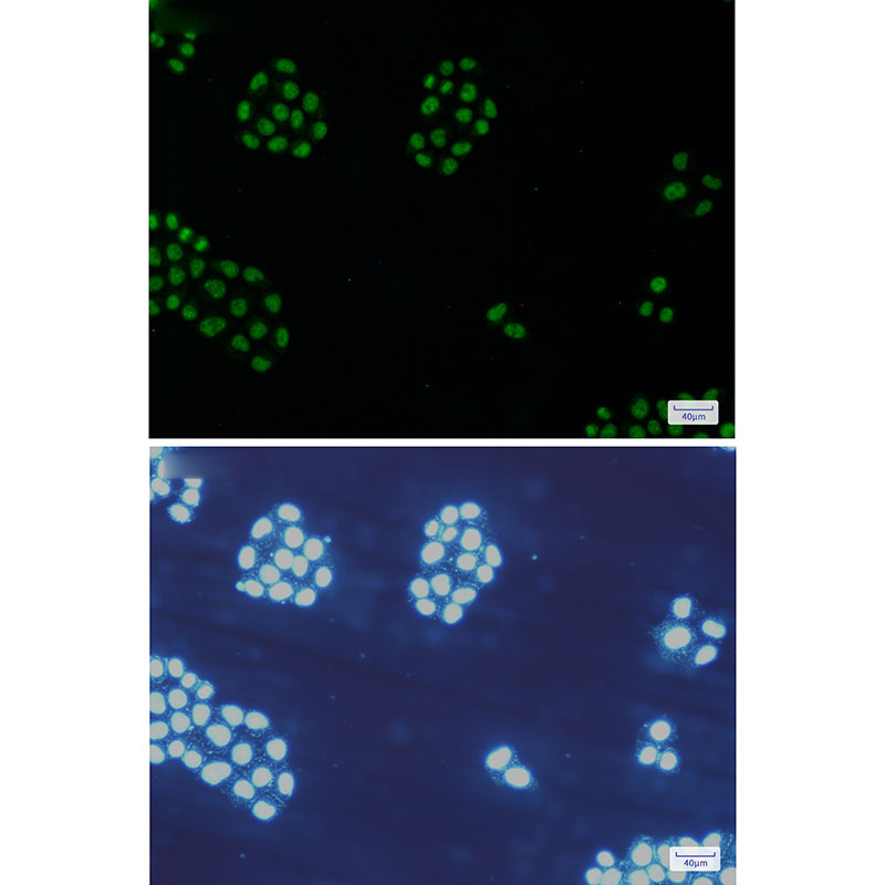 Rabbit Monoclonal Antibody to MCM5