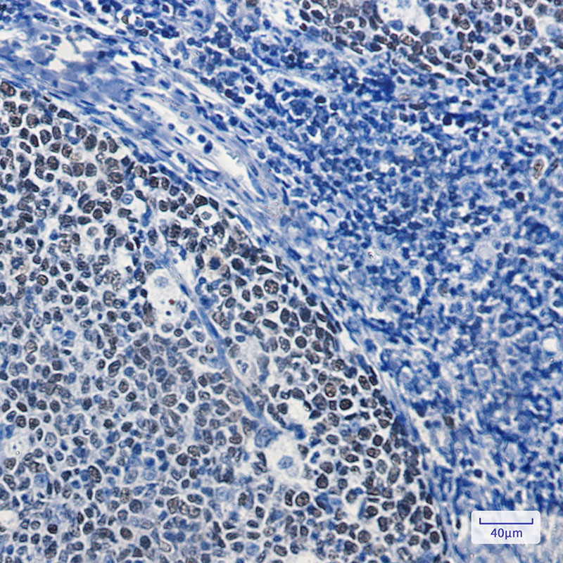 Rabbit Monoclonal Antibody to MCM5