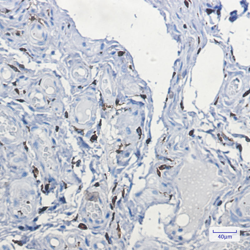 Rabbit Monoclonal Antibody to Factor XIIIa