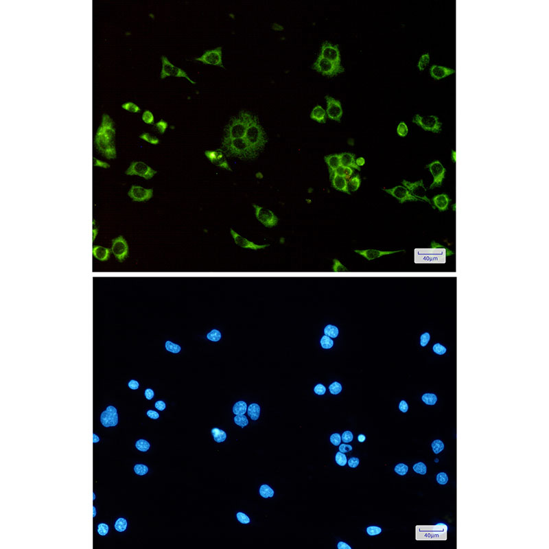 Rabbit Monoclonal Antibody to ATP Synthase C