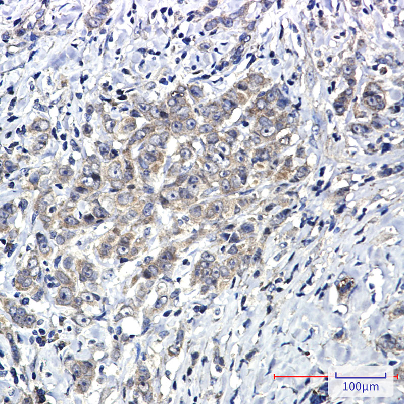 Rabbit Monoclonal Antibody to SHP2