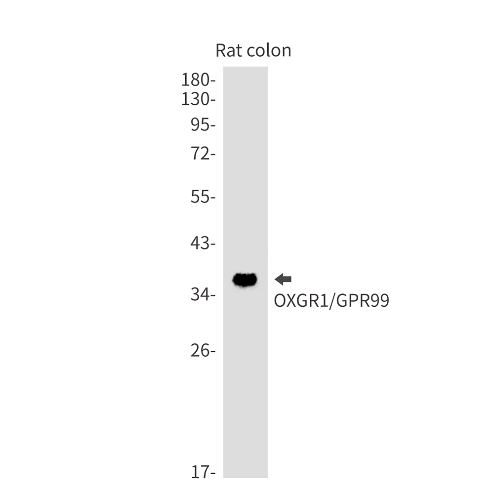 OXGR1