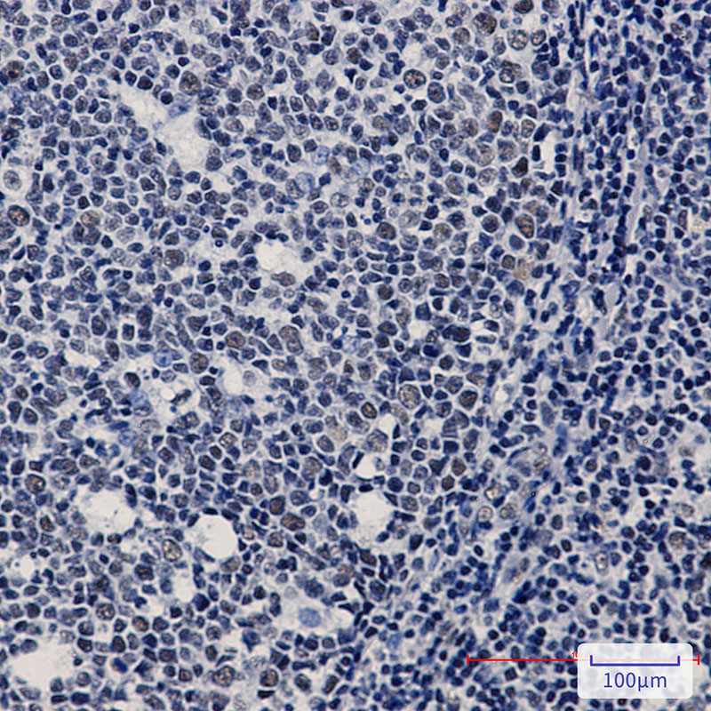 Rabbit Monoclonal Antibody to WTAP