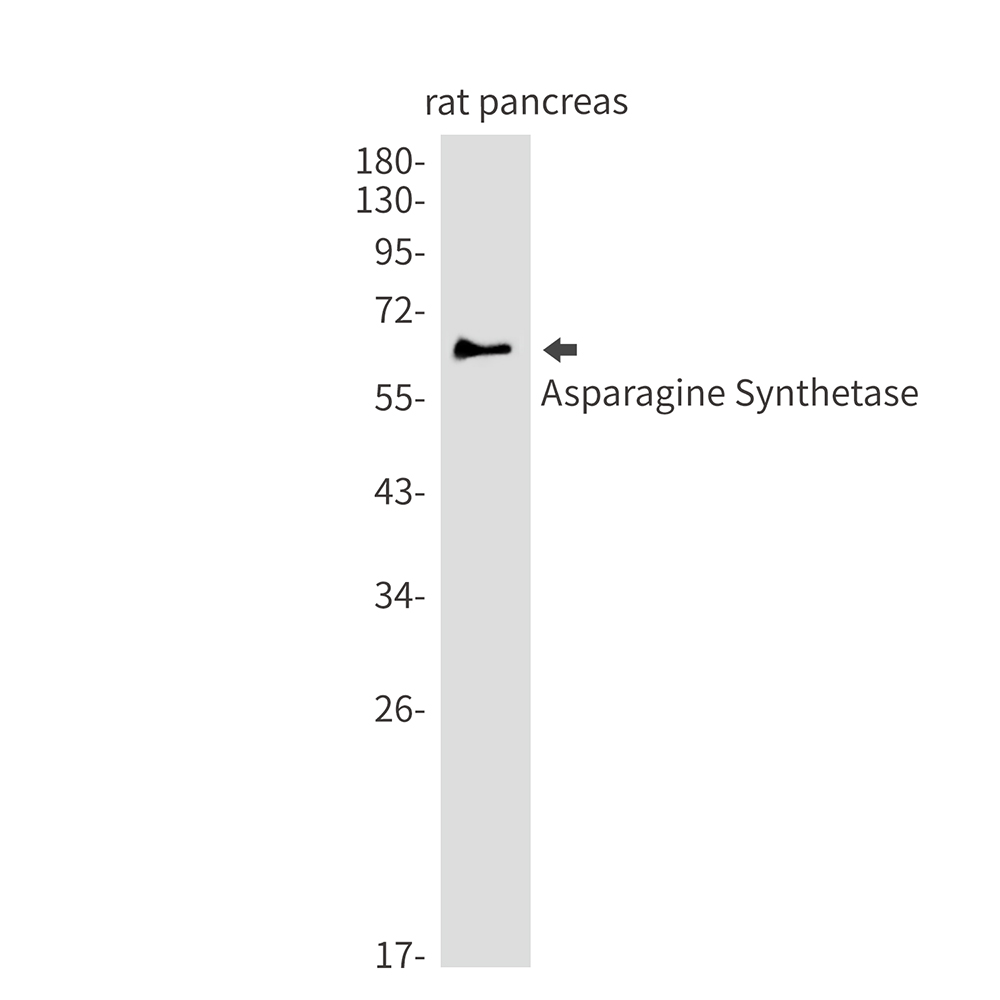 Asparagine Synthetase