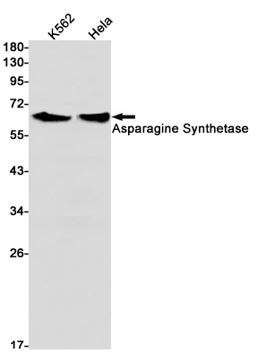 Rabbit Monoclonal Antibody to Asparagine Synthetase