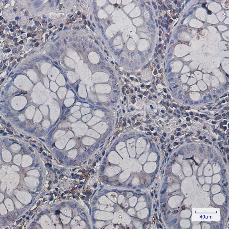 Rabbit Monoclonal Antibody to Annexin VI