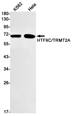 TRMT2A