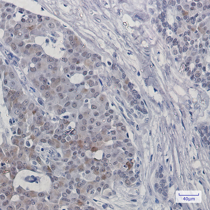 Rabbit Monoclonal Antibody to TRMT2A