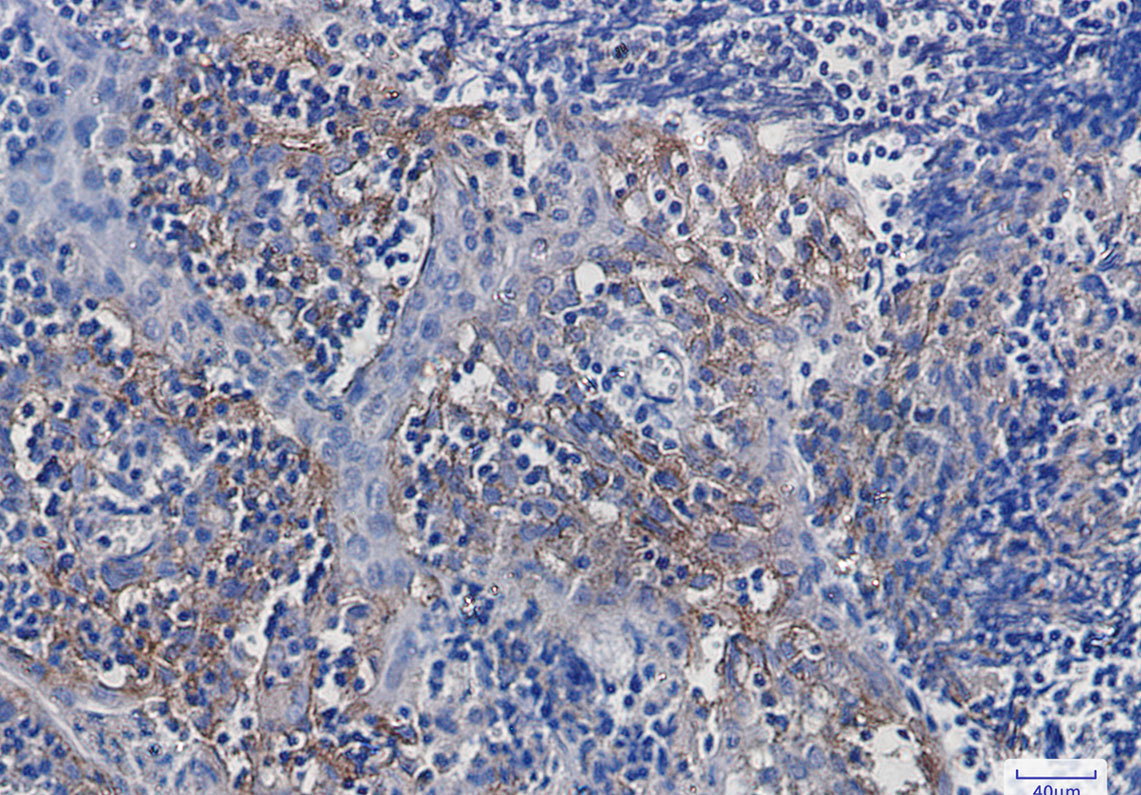 Rabbit Monoclonal Antibody to Integrin alpha V