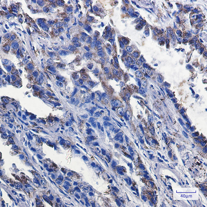 Rabbit Monoclonal Antibody to P2Y6