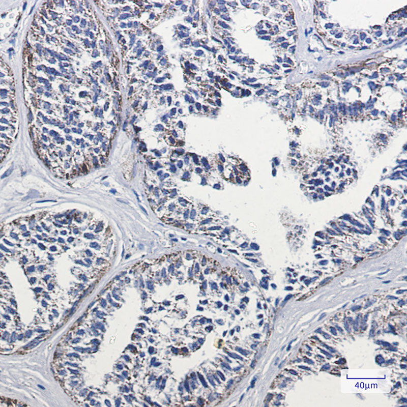 Rabbit Monoclonal Antibody to Lipoamide Dehydrogenase
