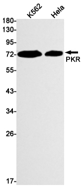 PKR