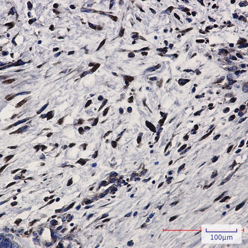 Rabbit Monoclonal Antibody to PKR