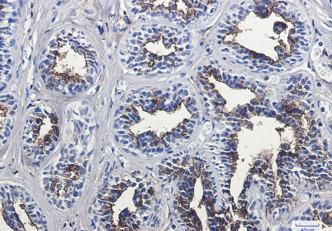 Rabbit Monoclonal Antibody to CD13