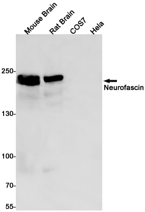 Rabbit Monoclonal Antibody to Neurofascin