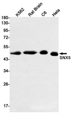 Rabbit Monoclonal Antibody to SNX5