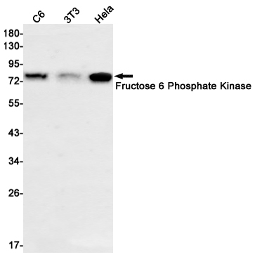 Fructose 6 Phosphate Kinase