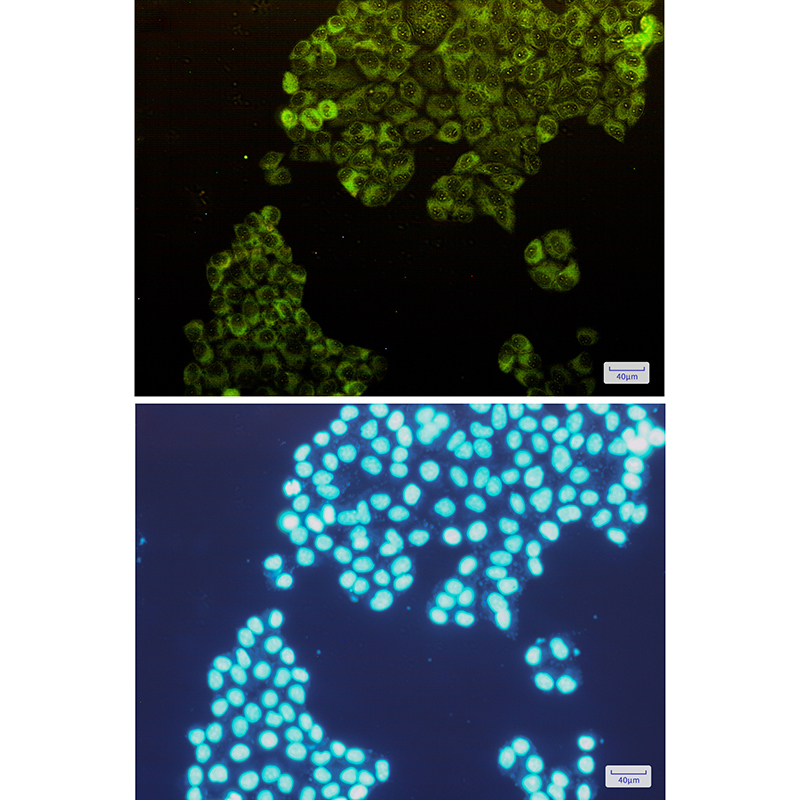 Rabbit Monoclonal Antibody to Fructose 6 Phosphate Kinase