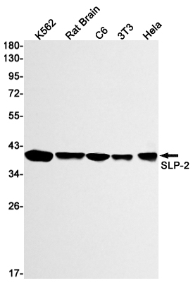 SLP2