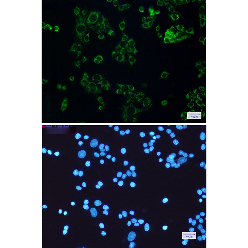 Rabbit Monoclonal Antibody to SLP2