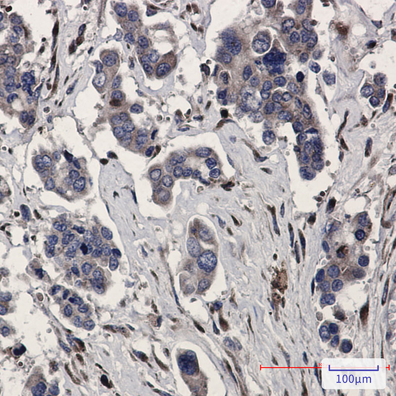 Rabbit Monoclonal Antibody to Rab5C