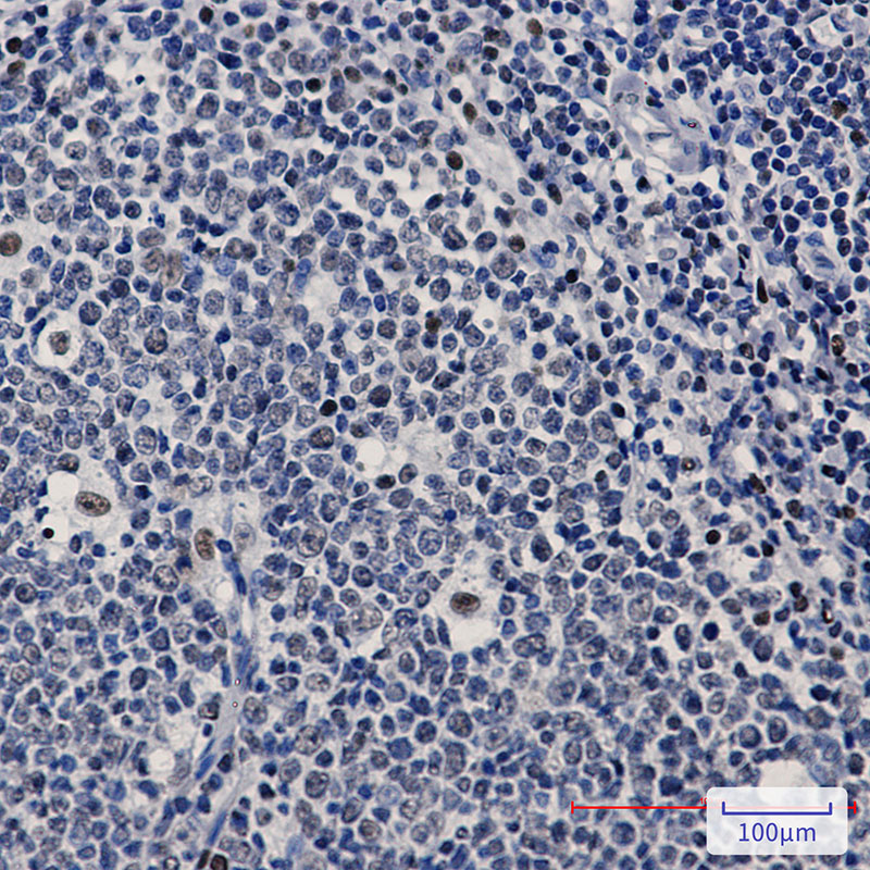 Rabbit Monoclonal Antibody to PREB