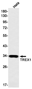 TREX1