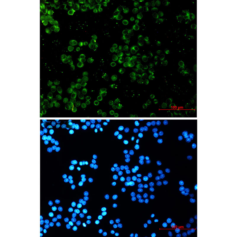 Rabbit Monoclonal Antibody to TREX1