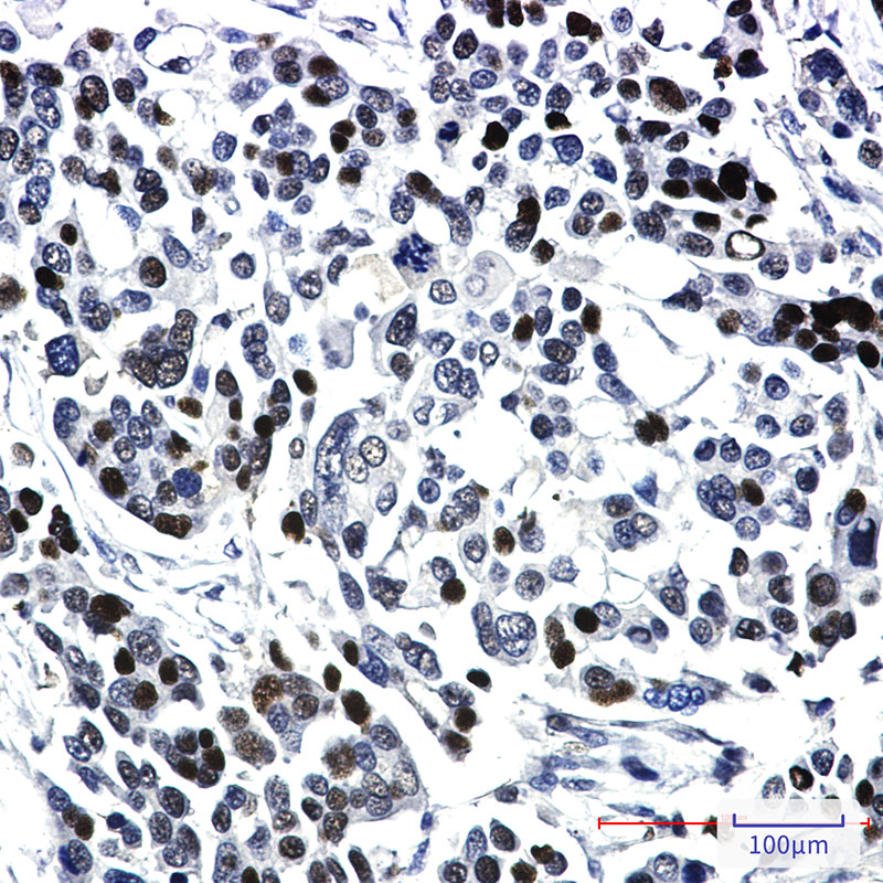 Rabbit Monoclonal Antibody to KAT13A