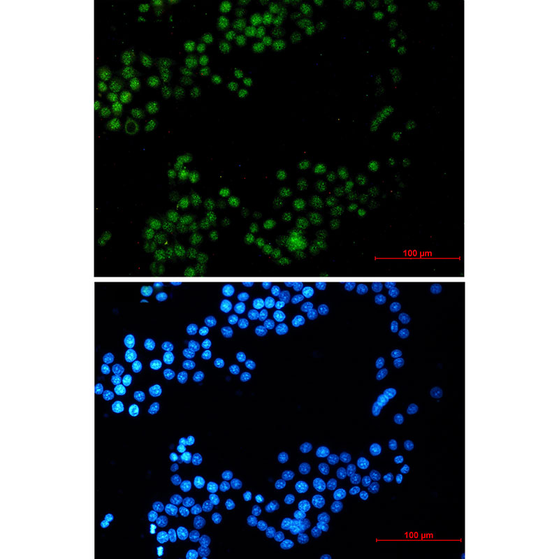 Rabbit Monoclonal Antibody to CRTC3