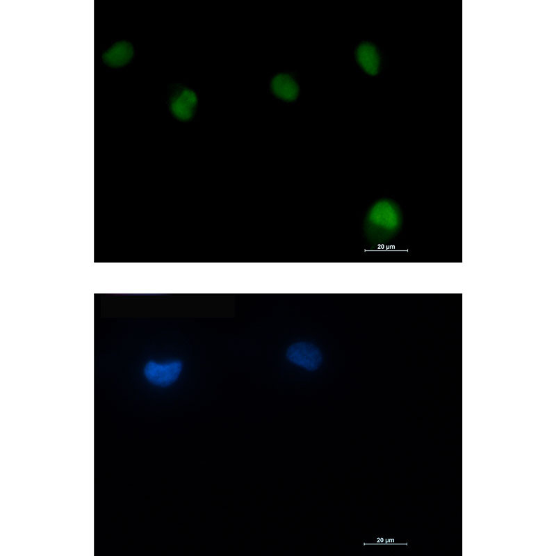 Rabbit Monoclonal Antibody to ATM