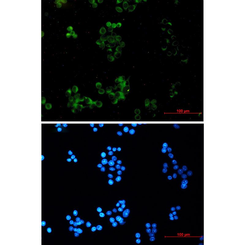 Rabbit Monoclonal Antibody to Amyloid Precursor Protein