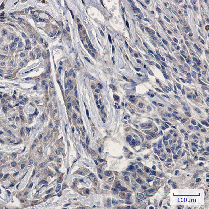 Rabbit Monoclonal Antibody to Amyloid Precursor Protein