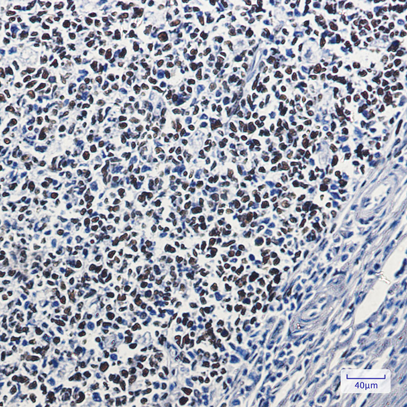 Rabbit Monoclonal Antibody to MSH6