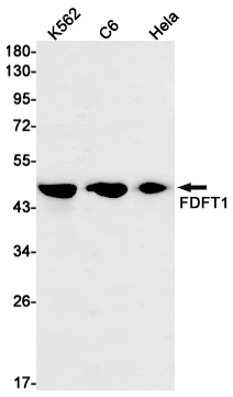 FDFT1