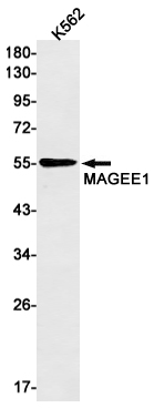 MAGEC2