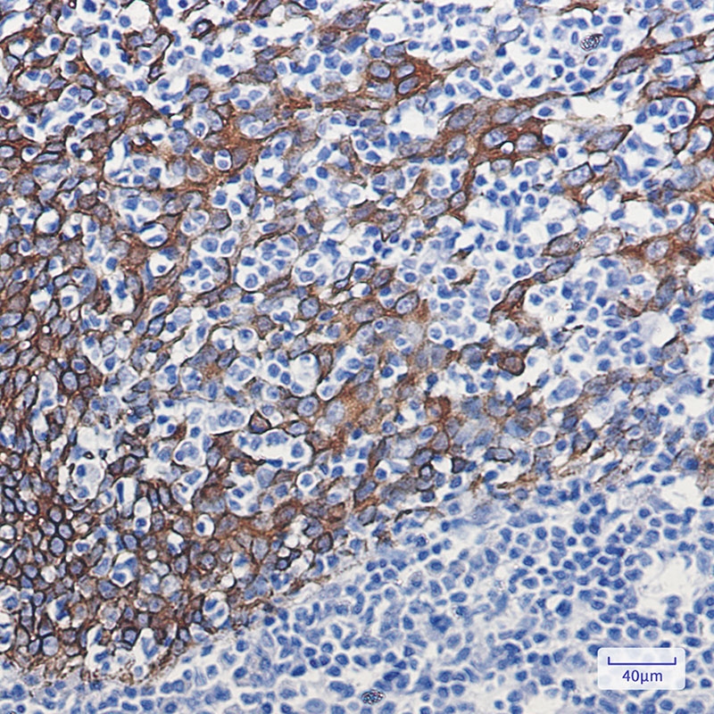 Rabbit Monoclonal Antibody to Cytokeratin 16