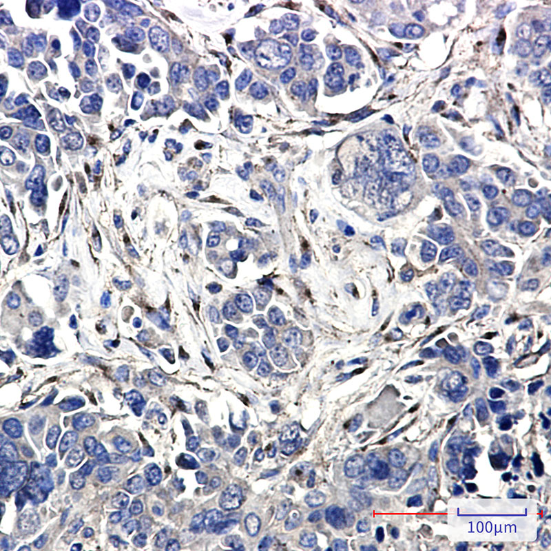Rabbit Monoclonal Antibody to LRP1