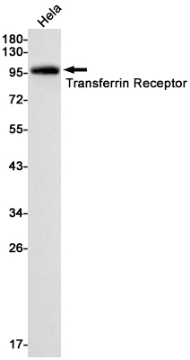 Transferrin Receptor 1