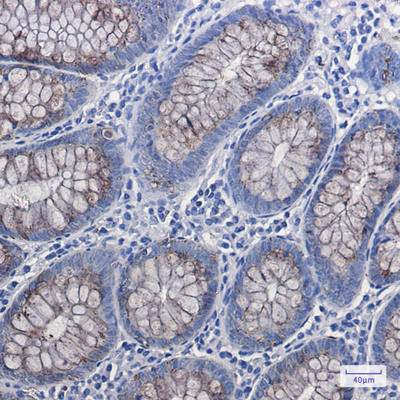 Rabbit Monoclonal Antibody to Anterior Gradient 2
