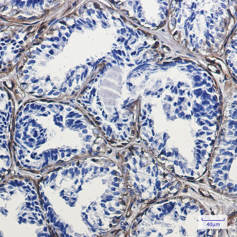 Rabbit Monoclonal Antibody to Caveolin 1