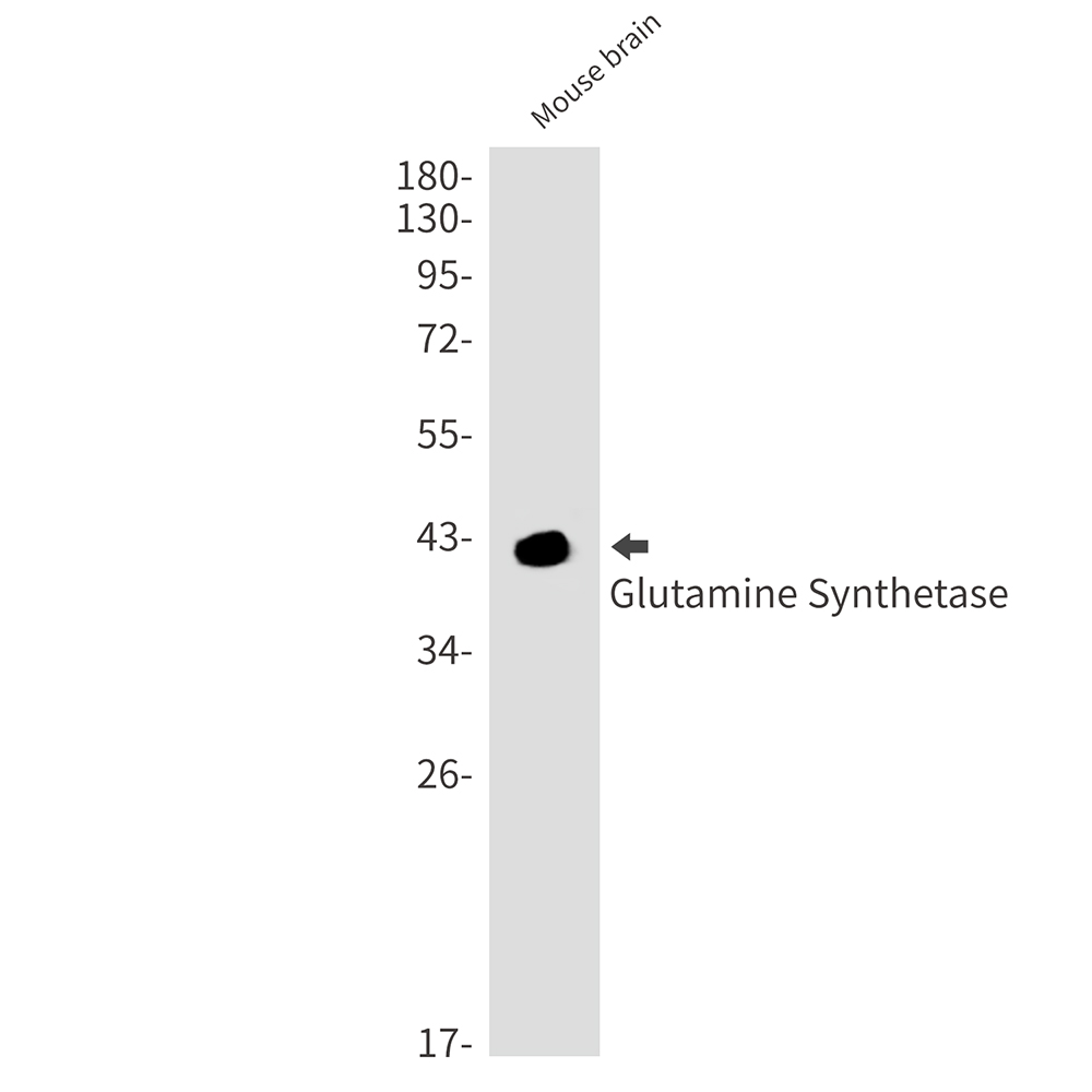 Glutamine Synthetase
