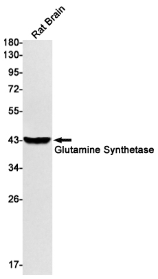 Rabbit Monoclonal Antibody to Glutamine Synthetase