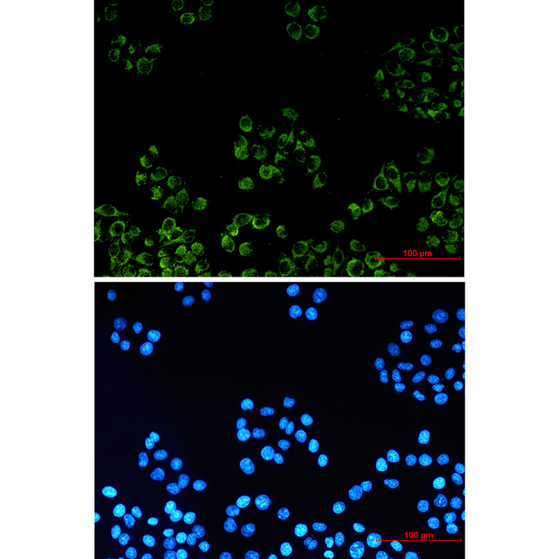 Rabbit Monoclonal Antibody to PBR