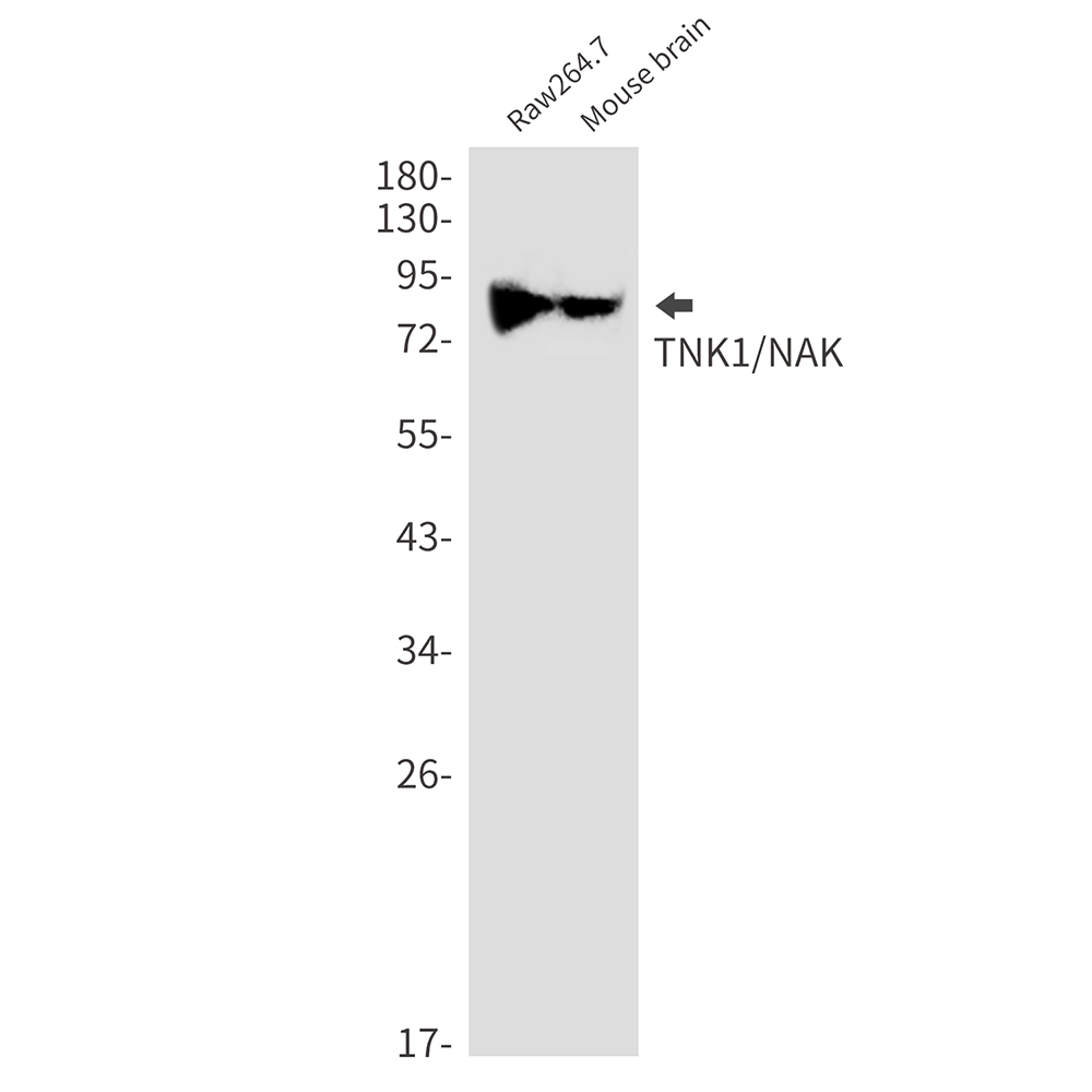 TBK1