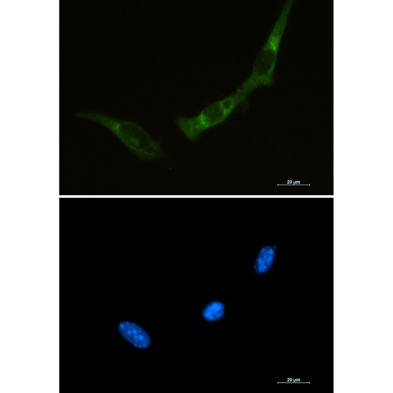 Rabbit Monoclonal Antibody to PKR
