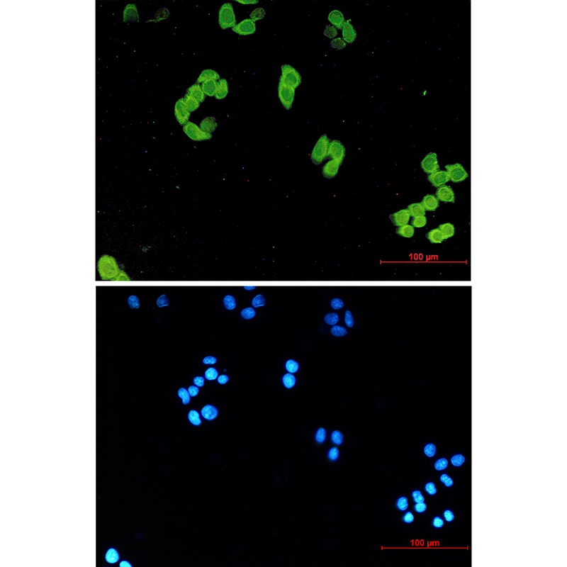 Rabbit Monoclonal Antibody to PARK7/DJ1