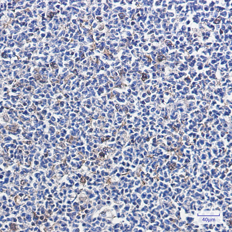 Rabbit Monoclonal Antibody to PARK7/DJ1