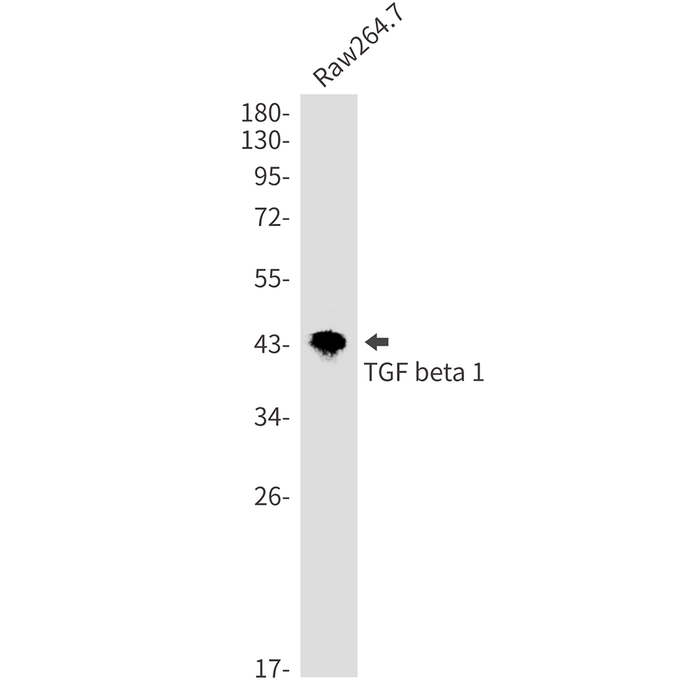 TGF beta 1