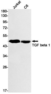 Rabbit Monoclonal Antibody to TGF beta 1